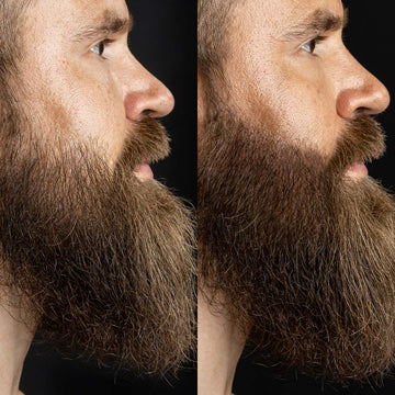 Invisible Sweatproof Beard Patch Filler